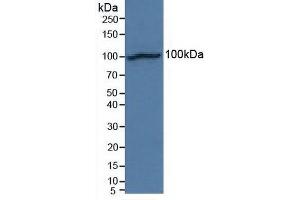 Detection of NCAD in Human Hela Cells using Polyclonal Antibody to N-cadherin (NCAD) (N-Cadherin antibody  (AA 45-238))