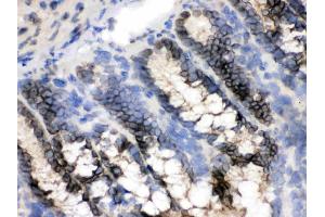 Immunohistochemistry (IHC) image for anti-Exportin 1 (XPO1) (AA 966-1071) antibody (ABIN4886771)