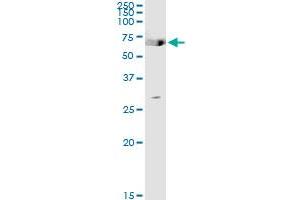 Immunoprecipitation of TGM2 transfected lysate using anti-TGM2 MaxPab rabbit polyclonal antibody and Protein A Magnetic Bead , and immunoblotted with TGM2 purified MaxPab mouse polyclonal antibody (B01P) . (Transglutaminase 2 antibody  (AA 1-548))