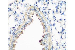 Immunohistochemistry of paraffin-embedded Mouse lung using CAV3 Polyclonal Antibody at dilution of 1:200 (40x lens). (Caveolin 3 antibody)