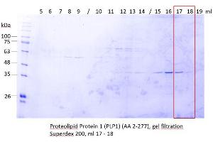 Image no. 2 for Proteolipid Protein 1 (PLP1) (AA 2-277) protein (ABIN3084135) (PLP1 Protein (AA 2-277))