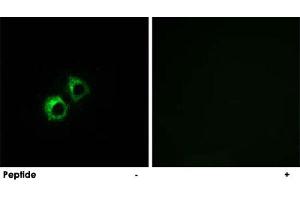 Immunofluorescence analysis of MCF-7 cells, using MRPS21 polyclonal antibody .