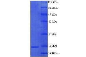 MPZ Protein (AA 30-153) (His tag)