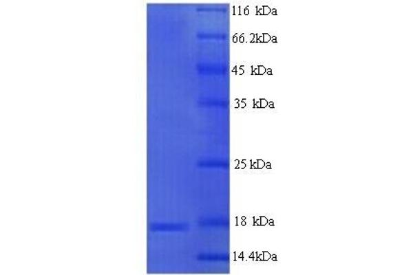 MPZ Protein (AA 30-153) (His tag)