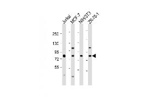 All lanes : Anti-ARHGEF7 Antibody (C-Term) at 1:2000 dilution Lane 1: Jurkat whole cell lysate Lane 2: MCF-7 whole cell lysate Lane 3: NIH/3T3 whole cell lysate Lane 4: ZR-75-1 whole cell lysate Lysates/proteins at 20 μg per lane. (ARHGEF7 antibody  (AA 654-688))