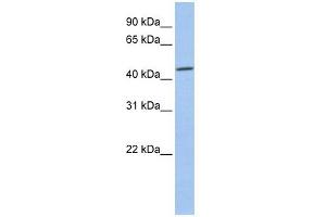 CK2 alpha 1 antibody used at 1 ug/ml to detect target protein. (CSNK2A1/CK II alpha antibody  (Middle Region))
