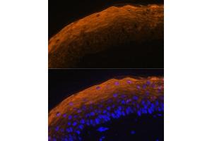 Immunofluorescence analysis of mouse skin using SPRR1A antibody (ABIN7270369) at dilution of 1:100. (SPRR1A antibody)