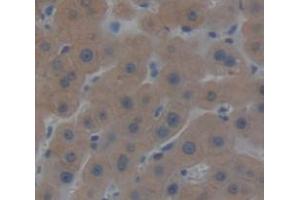 Immunohistochemistry (IHC) image for anti-Protein Disulfide Isomerase Family A, Member 3 (PDIA3) (AA 162-416) antibody (ABIN1860170)