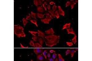 Immunofluorescence analysis of HeLa cells using TCAP Polyclonal Antibody (TCAP antibody)