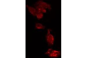 ABIN6275652 staining  HeLa cells by IF/ICC. (USP15 antibody  (N-Term))