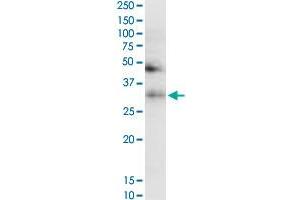 TF monoclonal antibody (M08), clone 1C2. (Transferrin antibody  (AA 551-650))