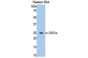 Western Blotting (WB) image for anti-Carboxypeptidase B2 (Plasma) (CPB2) (AA 187-327) antibody (ABIN1860680) (CPB2 antibody  (AA 187-327))