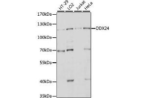 Western blot analysis of extracts of various cell lines, using DDX24 antibody. (DDX24 antibody)