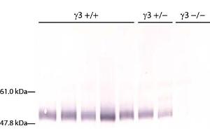 Serum from MRL/lpr IgG3 +/+, +/-, and -/- mice was resolved by electrophoresis, transferred to PVDF membrane, and probed with Goat Anti-Mouse IgG3, Human ads-AP followed by BCIP/NBT. (Goat anti-Mouse IgG3 (Heavy Chain) Antibody (Alkaline Phosphatase (AP)))