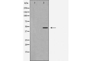Western blot analysis of Caspase 1 expression in 293 cells.