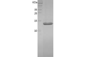 PMP2 Protein (AA 2-132) (His tag)
