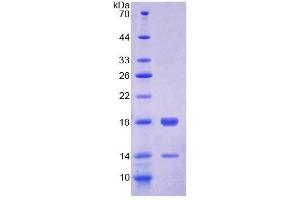 SDS-PAGE (SDS) image for Fatty Acid Binding Protein 4, Adipocyte (FABP4) (AA 1-125) protein (His tag) (ABIN6239043) (FABP4 Protein (AA 1-125) (His tag))