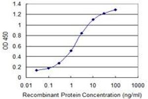 Detection limit for recombinant GST tagged WDR79 is 0. (WRAP53 antibody  (AA 62-160))