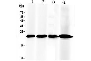 Western blot analysis of RBP4 using anti-RBP4 antibody .