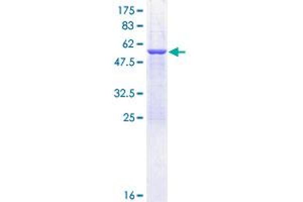 SPR Protein (AA 1-261) (GST tag)