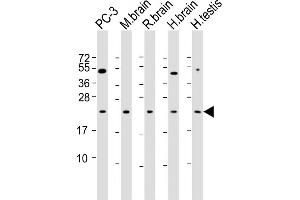 RAB18 antibody  (AA 1-206)