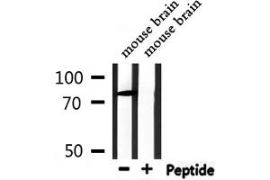 Western blot analysis of extracts from mouse brain, using CHFR Antibody. (CHFR antibody)