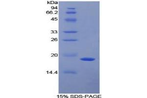 SDS-PAGE analysis of Mouse a2PI Protein. (alpha 2 Antiplasmin Protein)