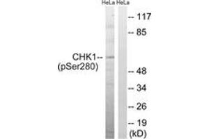 Western blot analysis of extracts from HeLa cells treated with Hu 2nM 24hours, using Chk1 (Phospho-Ser280) Antibody. (CHEK1 antibody  (pSer280))