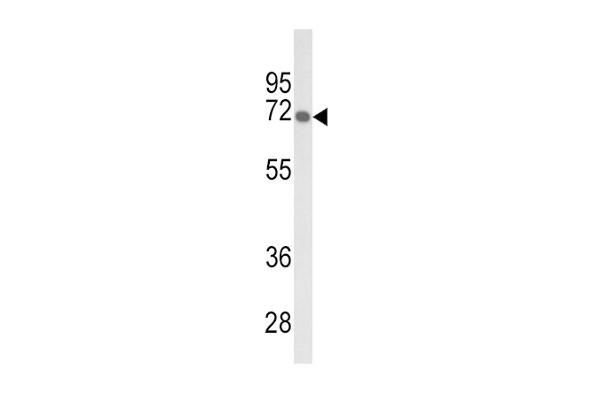 GBE1 antibody  (AA 527-556)