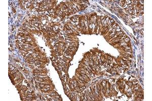 Immunohistochemistry (IHC) image for anti-Matrix Metalloproteinase 2 (MMP2) antibody (ABIN2855854)