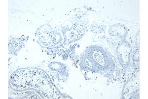 (ABIN302133) Negative Control showing staining of paraffin embedded Human Testis, with no primary antibody.