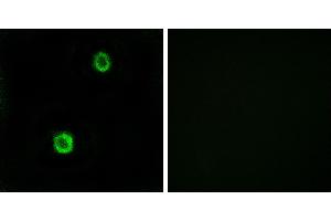 Peptide - +Immunohistochemistry analysis of paraffin-embedded human colon carcinoma tissue using CST1 antibody. (CST1 antibody)