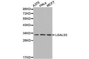 Western Blotting (WB) image for anti-Galectin 3 (LGALS3) antibody (ABIN1873541) (Galectin 3 antibody)