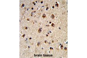 Formalin-fixed and paraffin-embedded human brain tissue reacted with ADRBK2 Antibody (N-term), which was peroxidase-conjugated to the secondary antibody, followed by DAB staining. (ADRBK2 antibody  (N-Term))