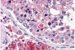 Human Testis (formalin-fixed, paraffin-embedded) stained with TMC6 antibody ABIN343905 at 5 ug/ml followed by biotinylated goat anti-rabbit IgG secondary antibody ABIN481713, alkaline phosphatase-streptavidin and chromogen. (TMC6 antibody  (N-Term))