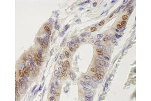 Immunohistochemistry (IHC) image for anti-Interferon Regulatory Factor 3 (IRF3) (AA 100-150) antibody (ABIN7448610) (IRF3 antibody  (AA 100-150))