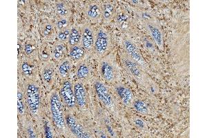 IHC analysis of EHD3 using anti-EHD3 antibody (ABIN7602777). (EHD3 antibody  (C-Term))