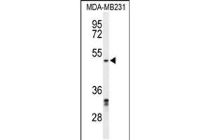 Western blot analysis of CBX2 Antibody in MDA-MB231 cell line lysates (35ug/lane)