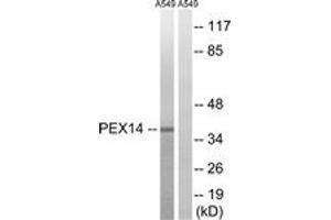 Western blot analysis of extracts from A549 cells, using PEX14 Antibody.