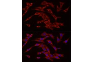 Immunofluorescence analysis of NIH/3T3 cells using cGAS Rabbit pAb (ABIN6134073, ABIN6143590, ABIN6143591 and ABIN6224360) at dilution of 1:50 (40x lens). (C6orf150 antibody  (AA 350-522))