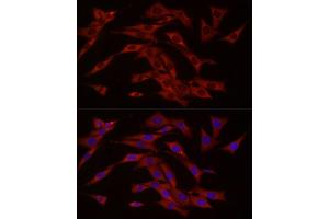 Immunofluorescence analysis of NIH/3T3 cells using cGAS Rabbit pAb (ABIN6134073, ABIN6143590, ABIN6143591 and ABIN6224360) at dilution of 1:50 (40x lens). (C6orf150 antibody  (AA 350-522))