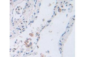 #VALUE! (PCDH20 antibody  (AA 64-209))