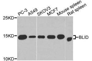Western blot analysis of extracts of various cell lines, using BLID antibody (ABIN4903053) at 1:1000 dilution. (BLID antibody)