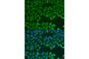 Immunofluorescence analysis of U2OS cells using MAP2K3 antibody (ABIN2737130) at dilution of 1:100. (MAP2K3 antibody)