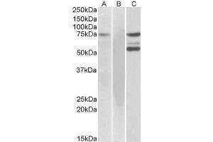 HEK293 lysate (10ug protein in RIPA buffer) overexpressing Human (ITK) with DYKDDDDK tag probed with ABIN184605 (1ug/ml) in Lane A and probed with anti-DYKDDDDK Tag (1/10000) in lane C. (ITK antibody  (C-Term))