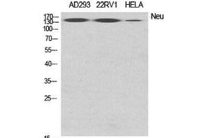 Western Blot analysis of various cells using ERBB2 Polyclonal Antibody at dilution of 1:2000. (ErbB2/Her2 antibody)