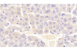 Detection of VAV1 in Mouse Liver Tissue using Polyclonal Antibody to Vav 1 Oncogene (VAV1) (VAV1 antibody  (AA 565-795))