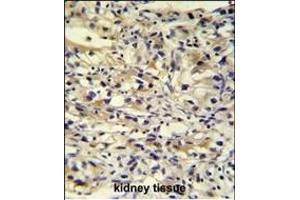 C1orf186 antibody (C-term) (ABIN652144 and ABIN2840564) immunohistochemistry analysis in formalin fixed and paraffin embedded human kidney tissue followed by peroxidase conjugation of the secondary antibody and DAB staining. (C1orf186 antibody  (C-Term))