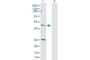 Western Blotting (WB) image for anti-Adaptor-Related Protein Complex 4, mu 1 Subunit (Ap4m1) (AA 1-453) antibody (ABIN522636)