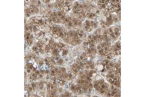 Immunohistochemical staining of human adrenal gland with LHPP polyclonal antibody  shows strong cytoplasmic positivity in cortical cells at 1:200-1:500 dilution. (LHPP antibody)